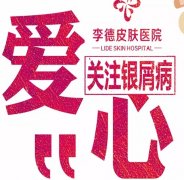 夏季治療銀屑病的5大優(yōu)勢(shì)