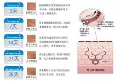 關(guān)于白癜風，一般來說有這三個方面的異常表現(xiàn)